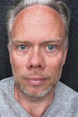 Cover image for Morten Egholm