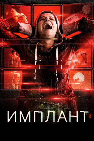 Poster for Имплант