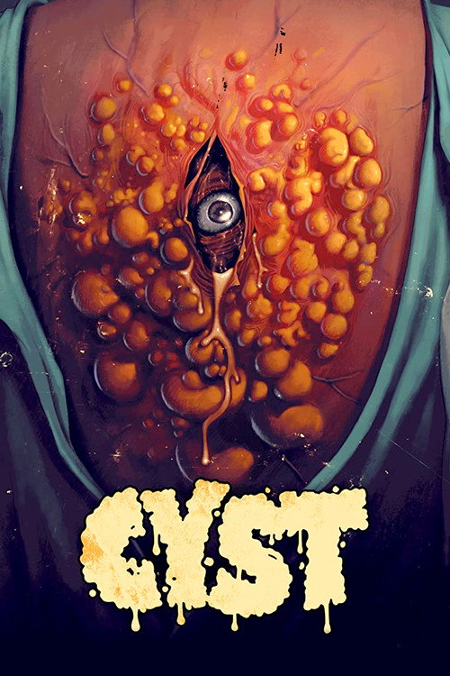 Poster for Киста