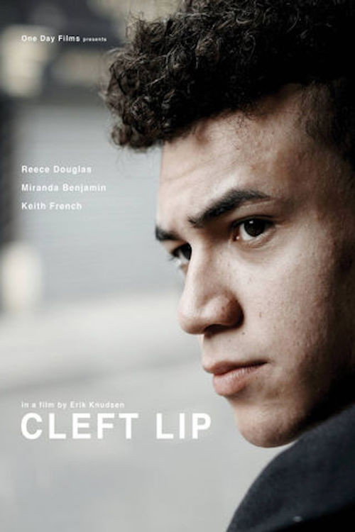 Poster for Cleft Lip